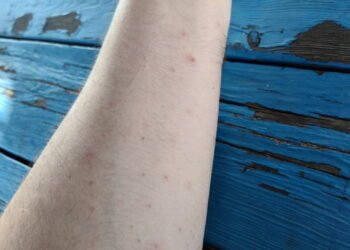 Henderson Manor residents say they deal with bedbugs, mice, violence and more
