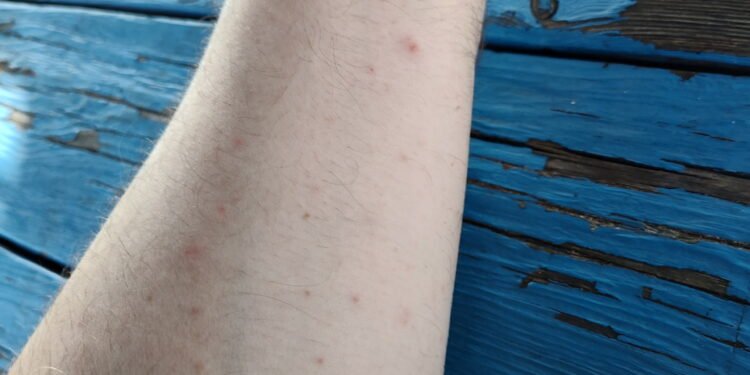 Henderson Manor residents say they deal with bedbugs, mice, violence and more